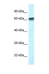 MBD1 antibody LS-C145754 Western blot of 293T Cell lysate. Antibody concentration 1 ug/ml.