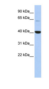 MBD1 antibody LS-C110486 Western blot of HepG2 cell lysate.