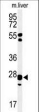 Western blot of GSTK1 Antibody in mouse liver tissue lysates (35 ug/lane). GSTK1 (arrow) was detected using the purified antibody.