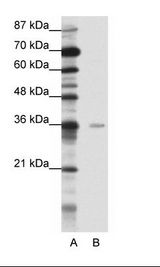 A: Marker, B: HepG2 Cell Lysate