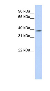 MBD2 antibody LS-C109671 Western blot of 721_B cell lysate.