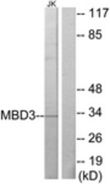 Western blot of extracts from Jurkat cells, using MBD3 Antibody. The lane on the right is treated with the synthesized peptide.
