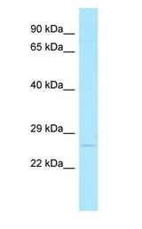 MBD3L1 antibody Western Blot of HT1080.