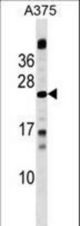 MBD3L1 Antibody western blot of A375 cell line lysates (35 ug/lane). The MBD3L1 antibody detected the MBD3L1 protein (arrow).