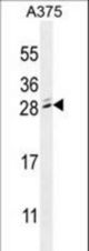 MBD3L2 Antibody western blot of A375 cell line lysates (35 ug/lane). The MBD3L2 antibody detected the MBD3L2 protein (arrow).