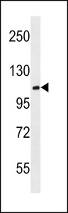 MBD6 Antibody western blot of mouse cerebellum tissue lysates (35 ug/lane). The MBD6 antibody detected the MBD6 protein (arrow).