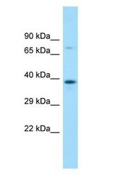 MBIP antibody Western Blot of Fetal Bladder.