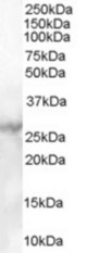 Antibody (1 ug/ml) staining of Human Heart lysate (35 ug protein in RIPA buffer). Primary incubation was 1 hour. Detected by chemiluminescence.