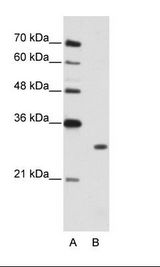 B: Jurkat Cell Lysate