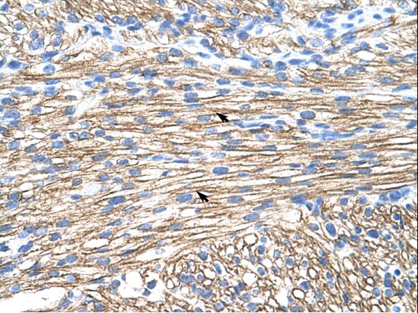 MBNL1 antibody LS-C30383 was used in IHC to stain formalin-fixed, paraffin-embedded human heart.
