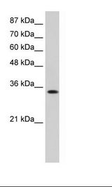 Jurkat Cell Lysate
