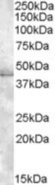 Antibody (1 ug/ml) staining of HeLa lysate (35 ug protein in RIPA buffer). Primary incubation was 1 hour. Detected by chemiluminescence