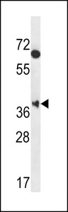 MBNL2 Antibody western blot of HeLa cell line lysates (35 ug/lane). The MBNL2 antibody detected the MBNL2 protein (arrow).