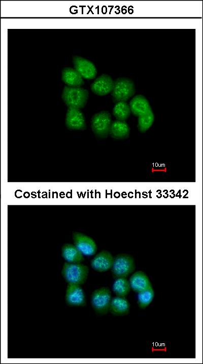 Immunofluorescence of paraformaldehyde-fixed A431 using MBNL3 antibody at 1:200 dilution.