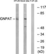 Western blot of extracts from HT-29/RAW264.7 cells, using GNPAT Antibody. The lane on the right is treated with the synthesized peptide.