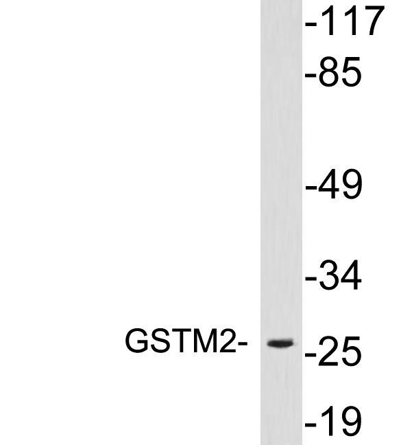 Western blot of extracts from 293 cells, using GSTM2 antibody.
