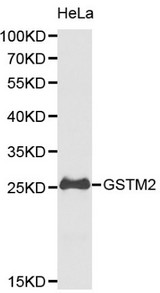 Western blot of GSTM2 pAb in extracts from Hela cells.