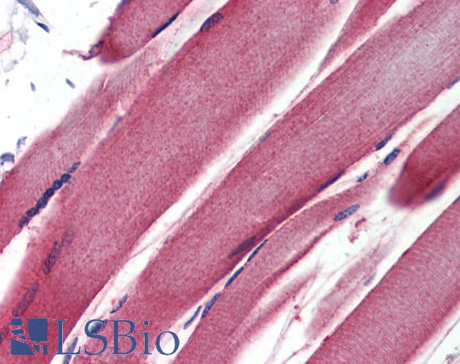 Anti-GSTM2 antibody IHC of human skeletal muscle. Immunohistochemistry of formalin-fixed, paraffin-embedded tissue after heat-induced antigen retrieval. Antibody LS-B3545 concentration 5 ug/ml.