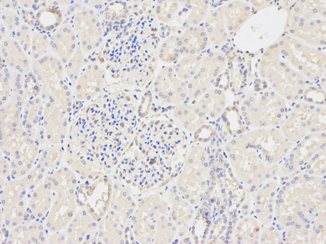 Immunohistochemistry of paraffin-embedded human kidney using GSTM2 antibody at dilution of 1:200 (200x lens).