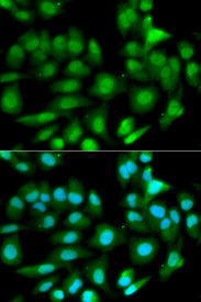 Immunofluorescence analysis of HeLa cell using GSTM2 antibody. Blue: DAPI for nuclear staining.