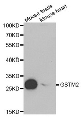 Western blot analysis of extracts of various cell lines, using GSTM2 antibody.