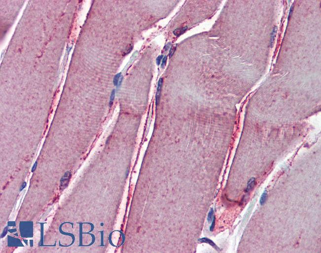 Anti-GSTM2 antibody IHC of human skeletal muscle. Immunohistochemistry of formalin-fixed, paraffin-embedded tissue after heat-induced antigen retrieval. Antibody LS-B6092 concentration 5 ug/ml.