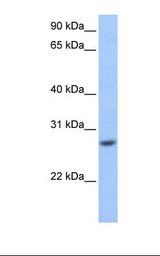 HepG2 cell lysate. Antibody concentration: 1.0 ug/ml. Gel concentration: 12%.