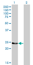 Western Blot analysis of GSTM4 expression in transfected 293T cell line by GSTM4 monoclonal antibody (M01), clone 4B4.Lane 1: GSTM4 transfected lysate(25.6 KDa).Lane 2: Non-transfected lysate.
