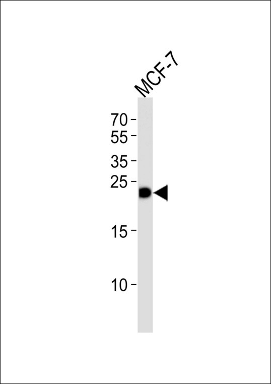 Western blot of lysate from MCF-7 cell line with GSTM4 Antibody. Antibody was diluted at 1:1000. A goat anti-rabbit IgG H&L (HRP) at 1:5000 dilution was used as the secondary antibody. Lysate at 35 ug.