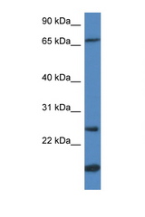 GSTM5 antibody LS-C102305 Western blot of HeLa Cell lysate. Antibody concentration 1 ug/ml.