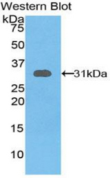Western blot of recombinant GSTO1.