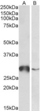 GSTO1 antibody (0.5 ug/ml) staining of Human Liver (A) and Peripheral Blood Lymphocytes (B) lysates (35 ug protein in RIPA buffer). Primary incubation was 1 hour. Detected by chemiluminescence.