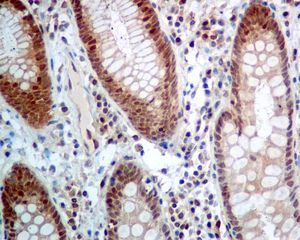 IHC of paraffin-embedded human colon tissue using anti-GSTO1 antibody.