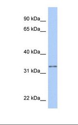 Hela cell lysate. Antibody concentration: 1.0 ug/ml. Gel concentration: 12%.