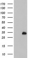 HEK293T cells were transfected with the pCMV6-ENTRY control (Left lane) or pCMV6-ENTRY GSTO2 (Right lane) cDNA for 48 hrs and lysed. Equivalent amounts of cell lysates (5 ug per lane) were separated by SDS-PAGE and immunoblotted with anti-GSTO2.