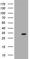 HEK293T cells were transfected with the pCMV6-ENTRY control (Left lane) or pCMV6-ENTRY GSTO2 (Right lane) cDNA for 48 hrs and lysed. Equivalent amounts of cell lysates (5 ug per lane) were separated by SDS-PAGE and immunoblotted with anti-GSTO2.