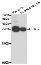 Western blot analysis of extracts of various cell lines, using GSTO2 antibody.