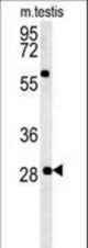 GSTO2 Antibody western blot of mouse testis tissue lysates (35 ug/lane). The GSTO2 antibody detected the GSTO2 protein (arrow).