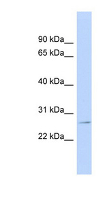 GSTP1 antibody LS-C111179 Western blot of Jurkat lysate.