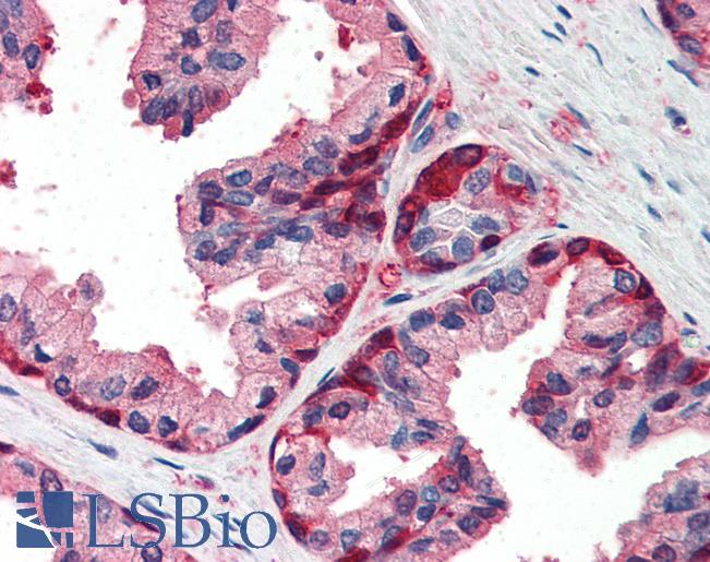 Anti-GSTP1 antibody IHC of human prostate. Immunohistochemistry of formalin-fixed, paraffin-embedded tissue after heat-induced antigen retrieval. Antibody LS-B2376 concentration 5 ug/ml.