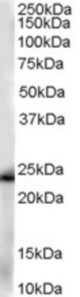 Antibody (0.01 ug/ml) staining of human kidney lysate (35 ug protein in RIPA buffer). Primary incubation was 1 hour. Detected by chemiluminescence.