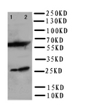 WB of GSTT1 antibody. Lane 1: COLO320 Cell Lysate. Lane 2: SW620 Cell Lysate..