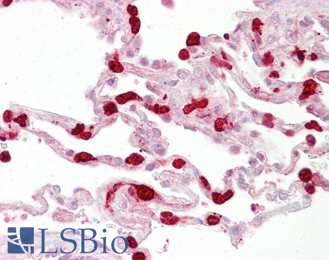 Anti-GSTT1 antibody IHC of human lung. Immunohistochemistry of formalin-fixed, paraffin-embedded tissue after heat-induced antigen retrieval. Antibody LS-B6884 concentration 5 ug/ml.