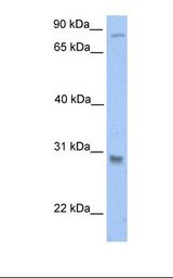 Jurkat cell lysate. Antibody concentration: 1.0 ug/ml. Gel concentration: 12%.