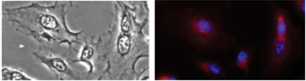 A549 (upper panel) and Vero E6 (lower panel) cells stained with purified rabbit anti-GRASP65, followed by Cy3-conjugated goat anti-rabbit IgG and DAPI.