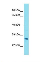 Western blot of Mouse Liver. Gstt2 antibody dilution 1.0 ug/ml.