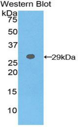 Western blot of recombinant GSTT2.