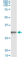 Immunoprecipitation of GSTT2 transfected lysate using anti-GSTT2 monoclonal antibody and Protein A Magnetic Bead, and immunoblotted with GSTT2 rabbit polyclonal antibody.