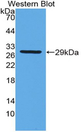 Western blot of recombinant GSTT2.