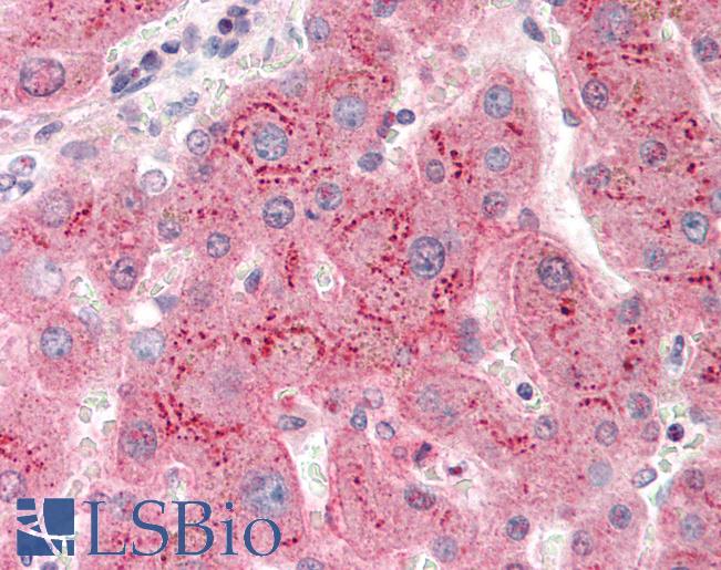 Human Liver: Formalin-Fixed, Paraffin-Embedded (FFPE)